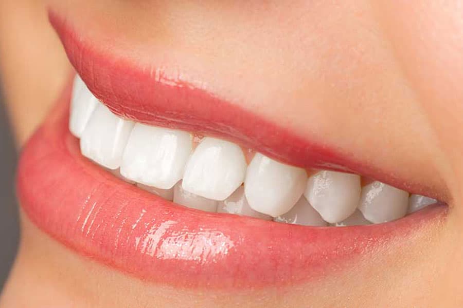 Implantes múltiplos